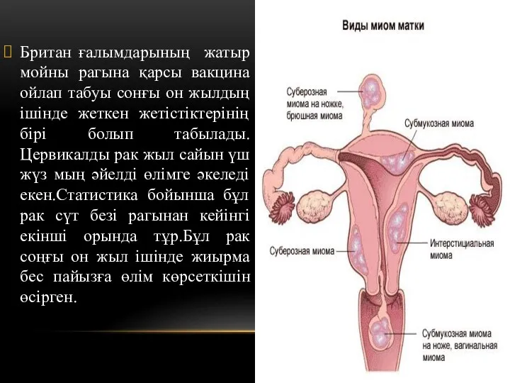 Британ ғалымдарының жатыр мойны рагына қарсы вакцина ойлап табуы сонғы