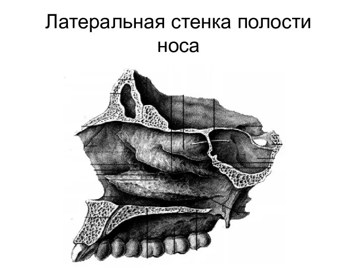 Латеральная стенка полости носа