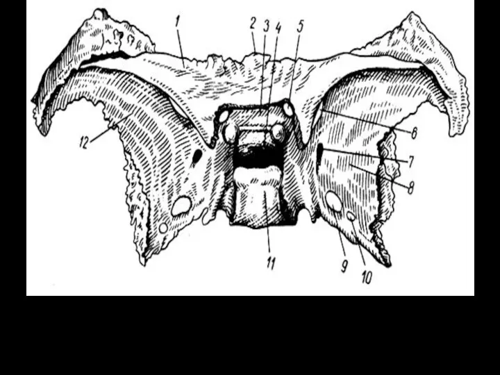 Клиновидная кость (вид сверху). 1 - малое крыло (левое); 2