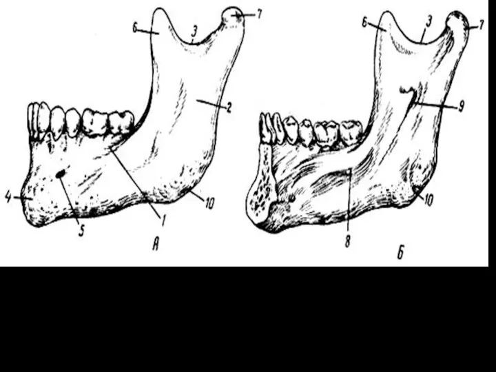 Нижняя челюсть. А - левая половина (вид снаружи); Б -
