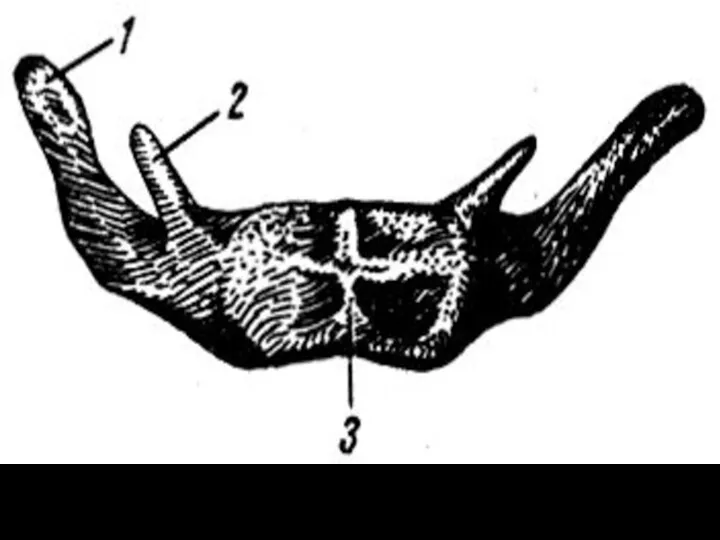 Подъязычная кость. 1 - большой рог; 2 - малый рог; 3 - тело