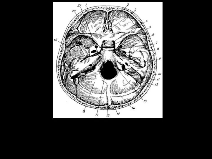 Внутреннее основание черепа. 1 - передняя черепная ямка; 2 -