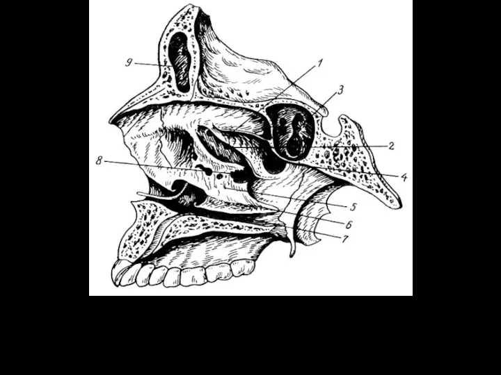 Латеральная стенка полости носа (правая). 1 - верхняя носовая раковина;