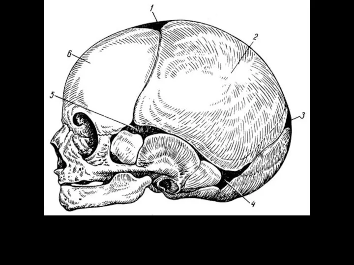 Череп новорожденного. 1 - передний родничок; 2 - теменной бугор;