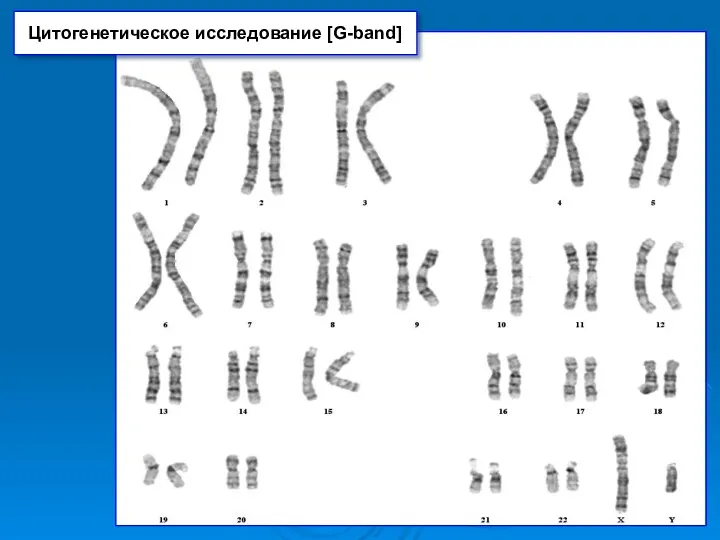 Цитогенетическое исследование [G-band]