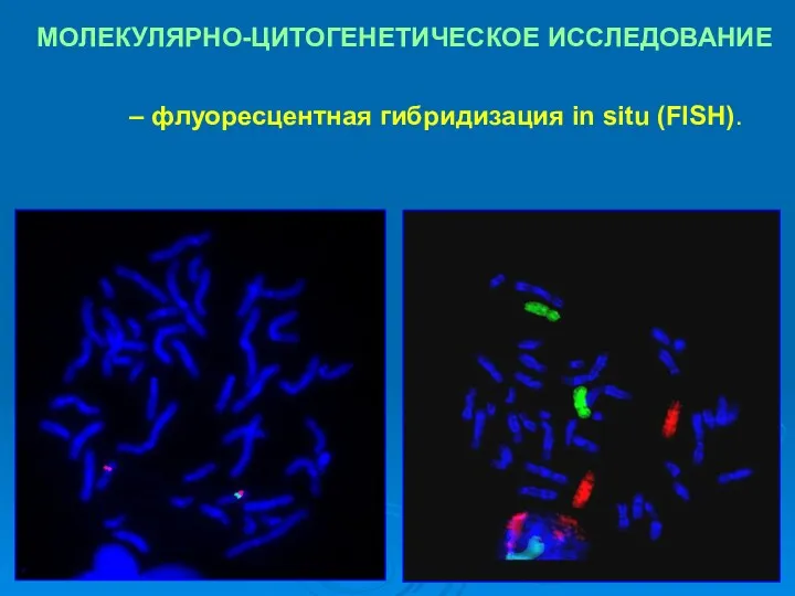 МОЛЕКУЛЯРНО-ЦИТОГЕНЕТИЧЕСКОЕ ИССЛЕДОВАНИЕ – флуоресцентная гибридизация in situ (FISH).