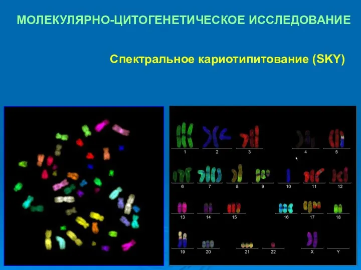 МОЛЕКУЛЯРНО-ЦИТОГЕНЕТИЧЕСКОЕ ИССЛЕДОВАНИЕ Спектральное кариотипитование (SKY)