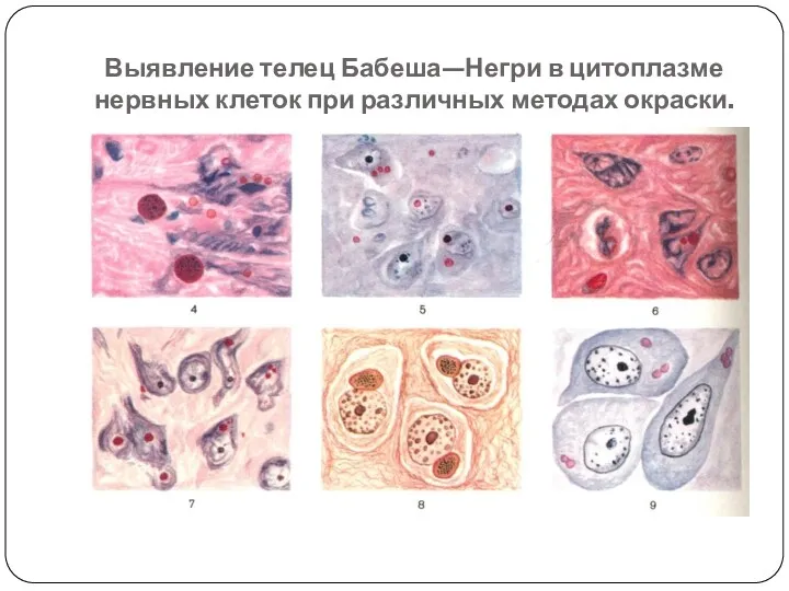 Выявление телец Бабеша—Негри в цитоплазме нервных клеток при различных методах окраски.