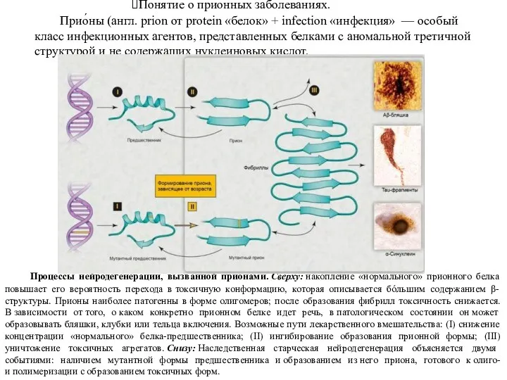 Понятие о прионных заболеваниях. Процессы нейродегенерации, вызванной прионами. Сверху: накопление
