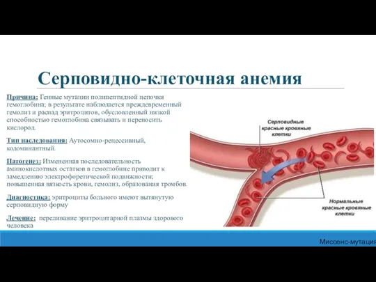 Серповидно-клеточная анемия Причина: Генные мутации полипептидной цепочки гемоглобина; в результате наблюдается преждевременный гемолиз