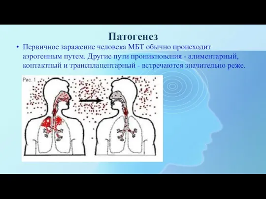 Патогенез Первичное заражение человека МБТ обычно происходит аэрогенным путем. Другие