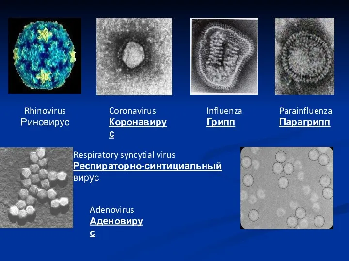 Rhinovirus Риновирус Coronavirus Коронавирус Influenza Грипп Parainfluenza Парагрипп Adenovirus Аденовирус Respiratory syncytial virus Респираторно-синтициальный вирус