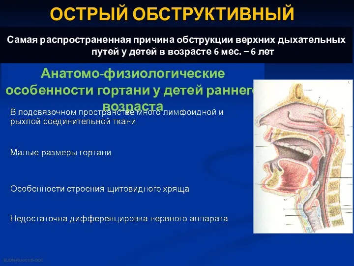 ОСТРЫЙ ОБСТРУКТИВНЫЙ ЛАРИНГИТ Самая распространенная причина обструкции верхних дыхательных путей