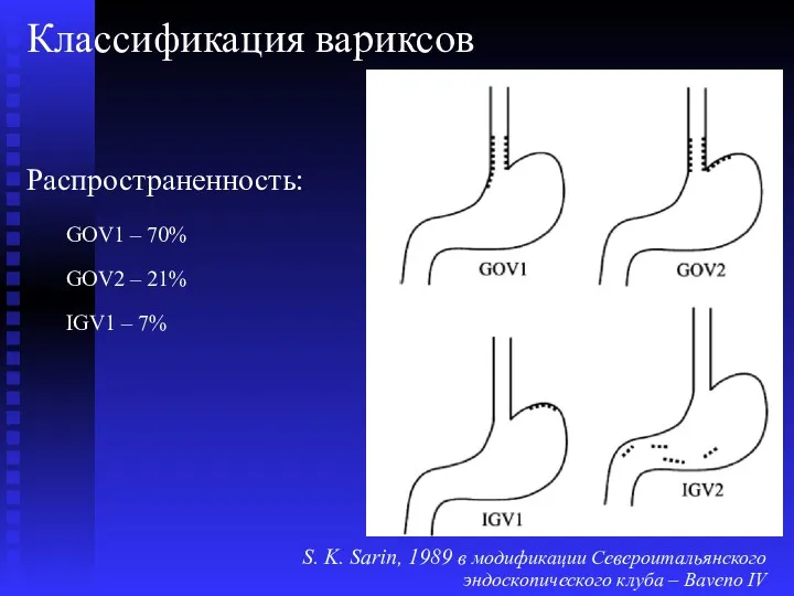 Классификация вариксов Распространенность: GOV1 – 70% GOV2 – 21% IGV1 – 7% S.