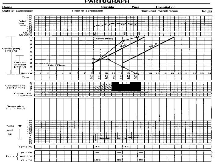 Filling of partogram.