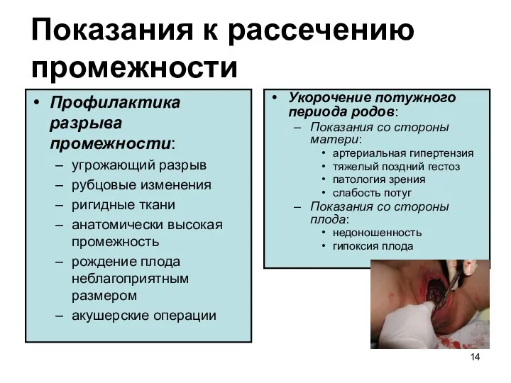 Показания к рассечению промежности Профилактика разрыва промежности: угрожающий разрыв рубцовые