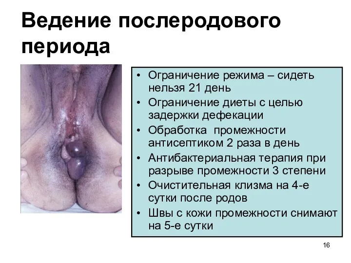 Ведение послеродового периода Ограничение режима – сидеть нельзя 21 день