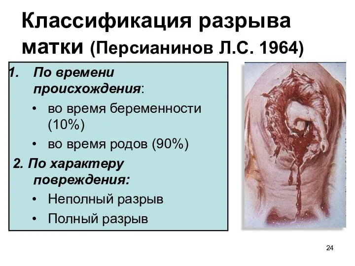 Классификация разрыва матки (Персианинов Л.С. 1964) По времени происхождения: во