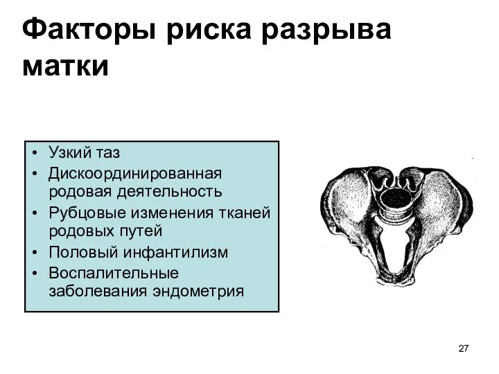 Факторы риска разрыва матки Узкий таз Дискоординированная родовая деятельность Рубцовые