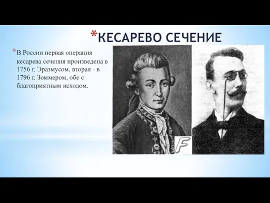 КЕСАРЕВО СЕЧЕНИЕ В России первая операция кесарева сечения произведена в