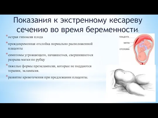 Показания к экстренному кесареву сечению во время беременности: острая гипоксия