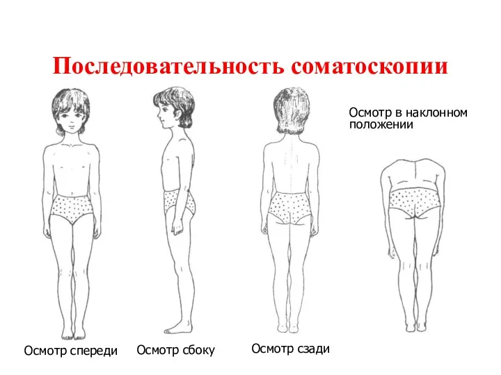 Осмотр спереди Осмотр сбоку Осмотр сзади Применение отвеса Осмотр в наклонном положении Последовательность соматоскопии