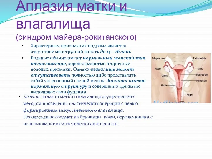 Аплазия матки и влагалища (синдром майера-рокитанского) Характерным признаком синдрома является отсутствие менструаций вплоть