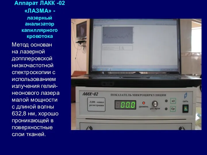 Аппарат ЛАКК -02 «ЛАЗМА» - лазерный анализатор капиллярного кровотока Метод