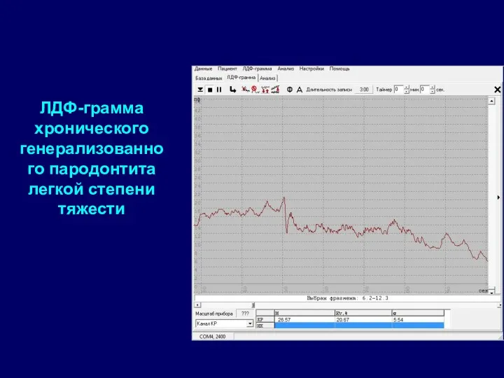 ЛДФ-грамма хронического генерализованного пародонтита легкой степени тяжести