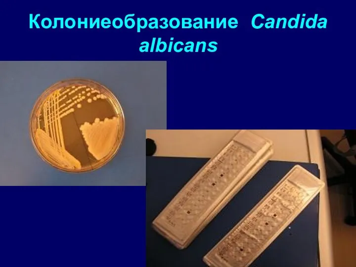 Колониеобразование Candida albicans