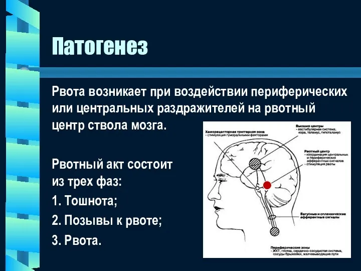 Патогенез Рвота возникает при воздействии периферических или центральных раздражителей на