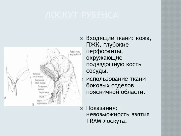 ЛОСКУТ РУБЕНСА Входящие ткани: кожа, ПЖК, глубокие перфоранты, окружающие подвздошную