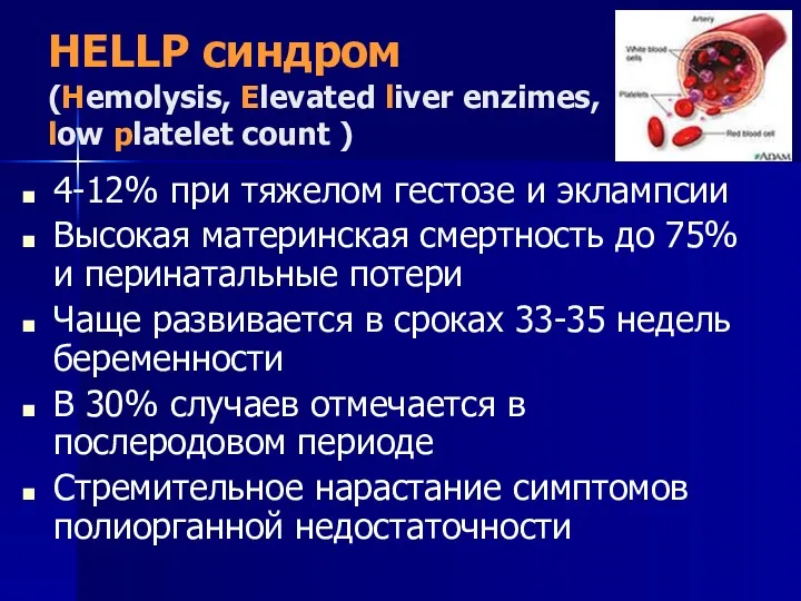 HELLP синдром (Hemolysis, Elevated liver enzimes, low platelet count )