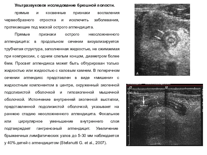 Ультразвуковое исследование брюшной полости. прямые и косвенные признаки воспаления червеобразного