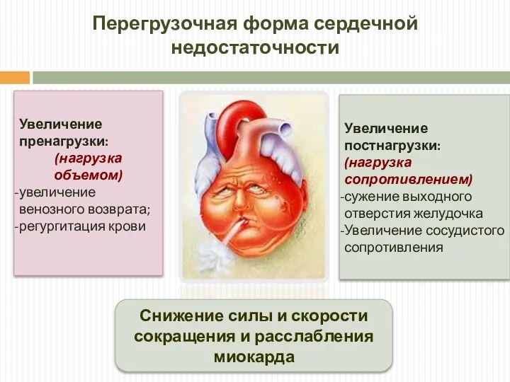 Перегрузочная форма сердечной недостаточности Увеличение пренагрузки: (нагрузка объемом) увеличение венозного возврата; регургитация крови