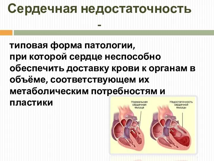 Сердечная недостаточность - типовая форма патологии, при которой сердце неспособно