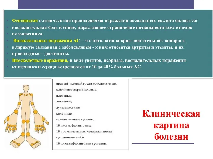 Клиническая картина болезни Основными клиническими проявлениями поражения аксиального скелета являются: