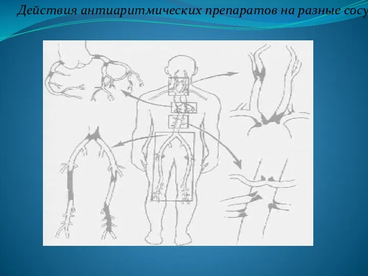 Действия антиаритмических препаратов на разные сосуды