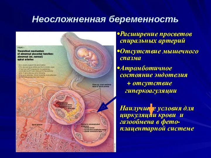 Расширение просветов спиральных артерий Отсутствие мышечного спазма Атромботичное состояние эндотелия