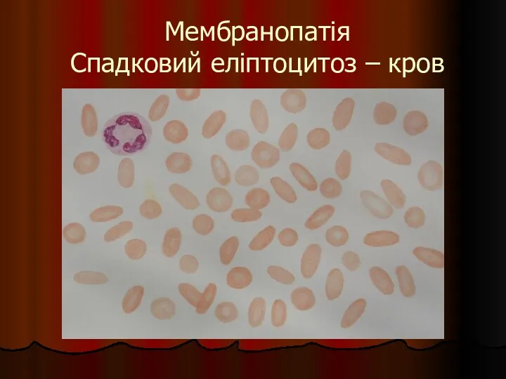 Мембранопатія Спадковий еліптоцитоз – кров