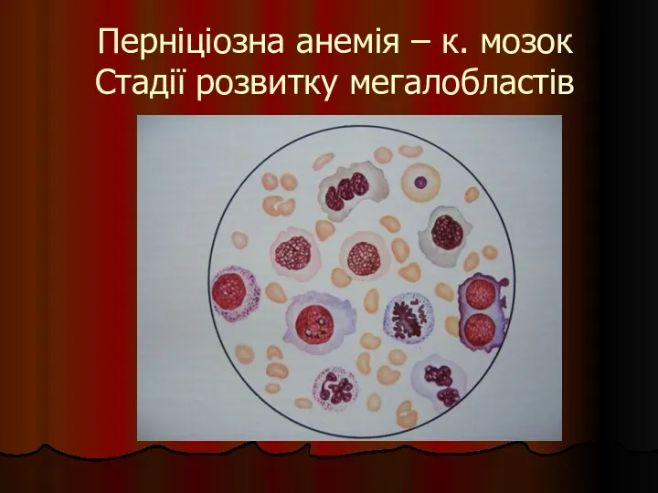 Перніціозна анемія – к. мозок Стадії розвитку мегалобластів