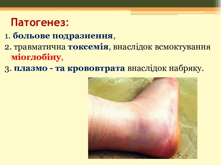 Патогенез: 1. больове подразнення, 2. травматична токсемія, внаслідок всмоктування міоглобіну, 3. плазмо -