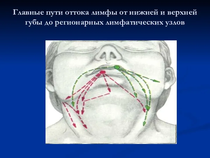 Главные пути оттока лимфы от нижней и верхней губы до регионарных лимфатических узлов