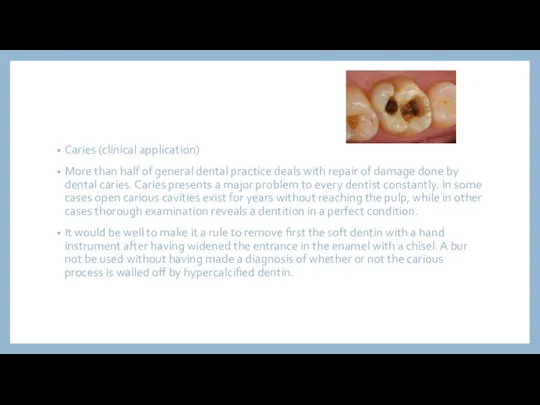 Caries (clinical application) More than half of general dental practice