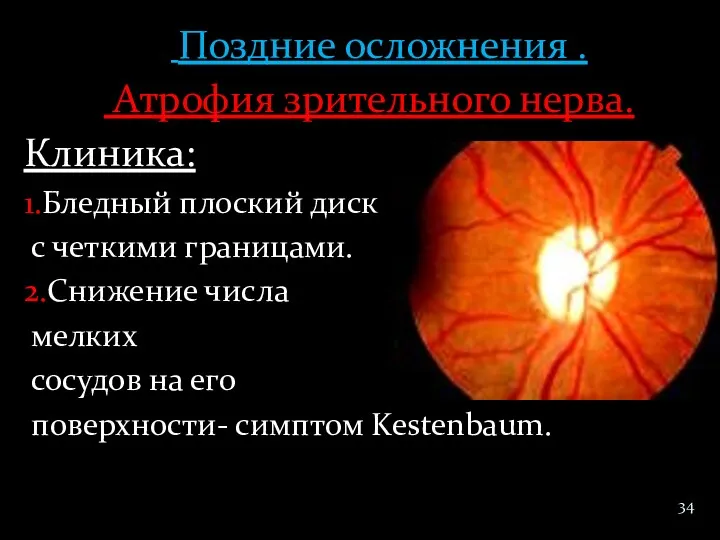 Поздние осложнения . Атрофия зрительного нерва. Клиника: 1.Бледный плоский диск