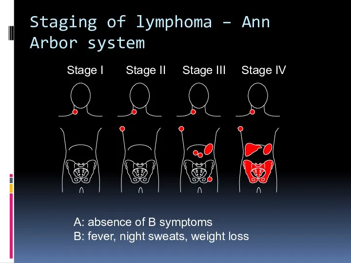 Staging of lymphoma – Ann Arbor system A: absence of