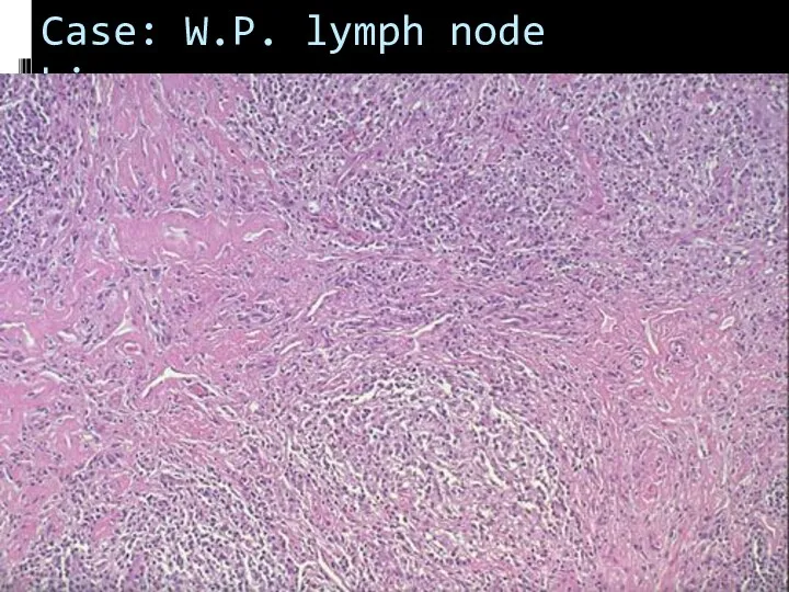 Case: W.P. lymph node biopsy