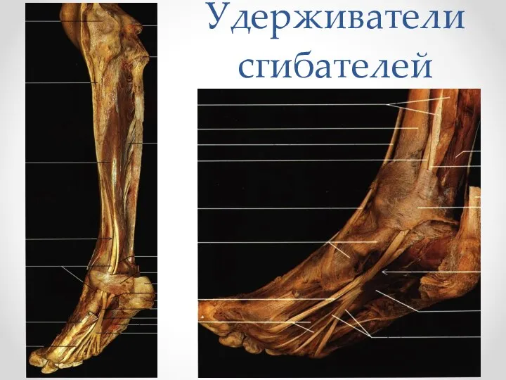 Удерживатели сгибателей