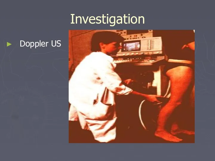Investigation Doppler US