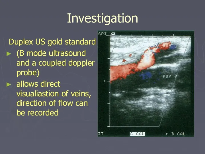 Investigation Duplex US gold standard (B mode ultrasound and a